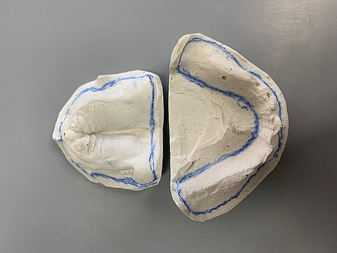 Гипсов отпечатък на горна и долна челюст, използван в стоматологията за създаване на точен модел на зъбите и захапката на пациента